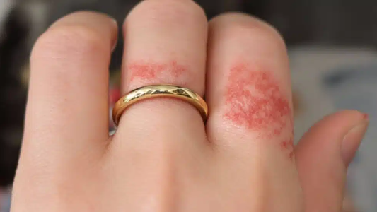 💎 A Guide to Choosing Jewelry for Sensitive Skin