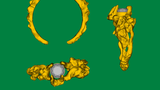 Glued-on vs. Set Stones